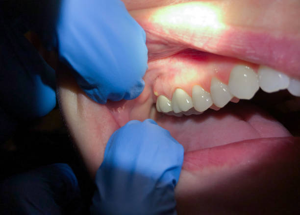 Best Emergency Orthodontic Repairs in Detroit Beach, MI