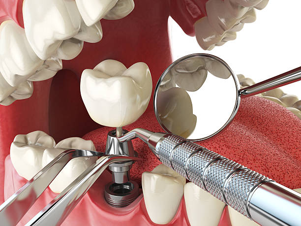 Best After-Hours Emergency Dentist in Detroit Beach, MI